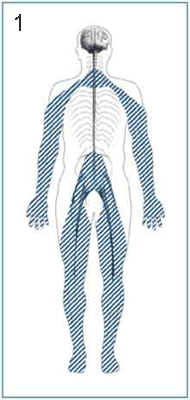 Sensory Peripheral Neuropathy Sensory Peripheral Neuropathy